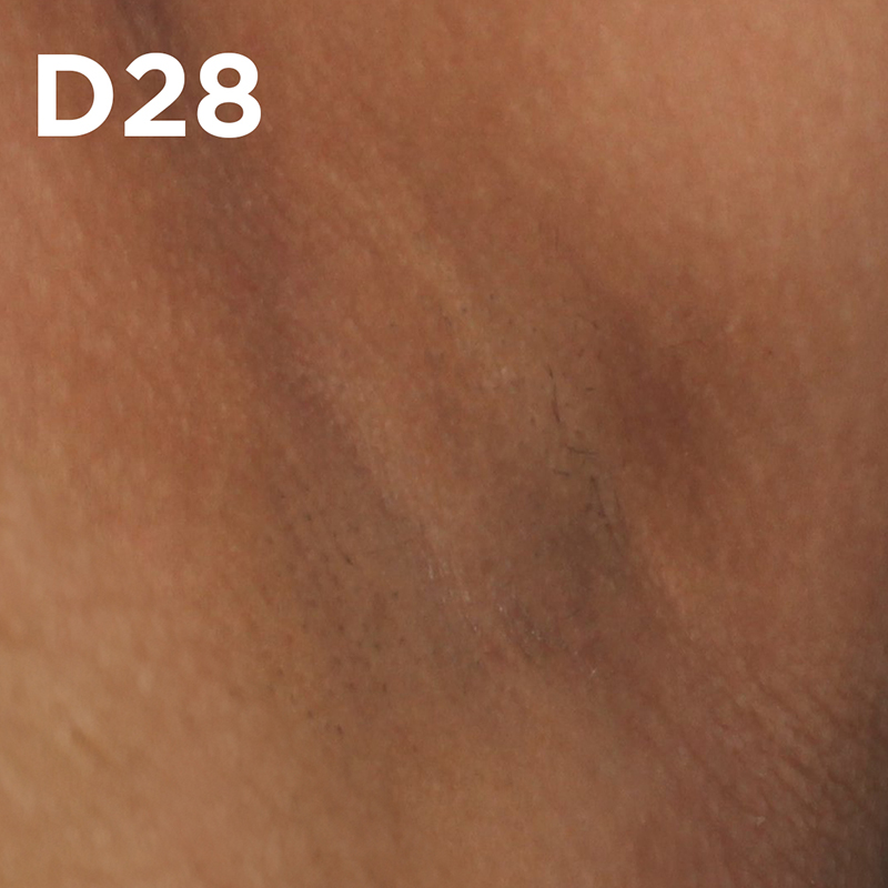 Clinicamente testado e aprovado em manchas escuras