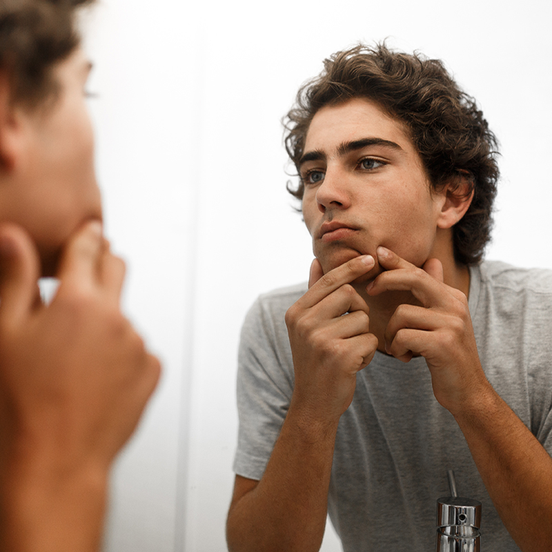 adolescente com borbulhas na frente do espelho