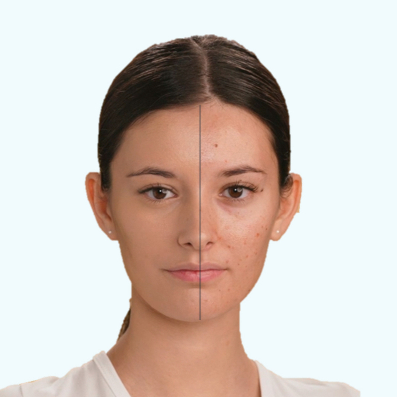 Photoderm cover touch resultados duradouros