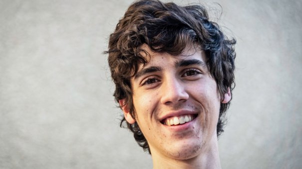 Adolescente com acne ativa