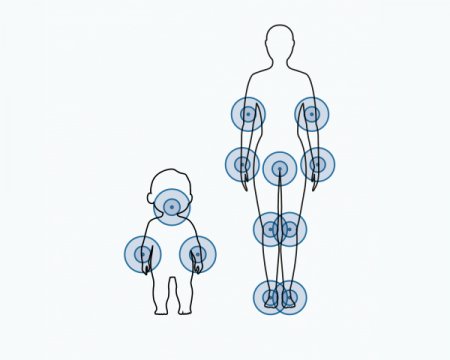 Diagrama de zonas afetadas pela atopia 