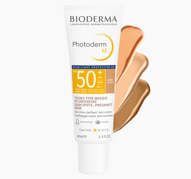 Imagem de tipos de melasma