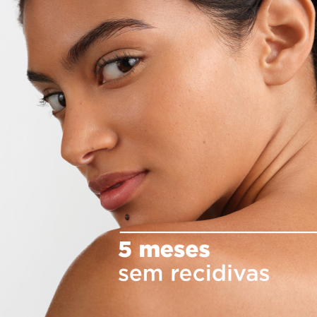 5 meses sem recidivas