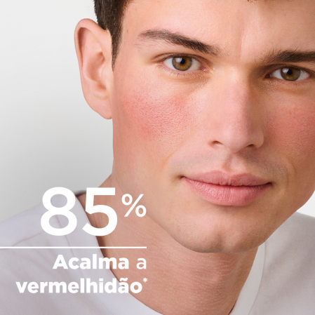 Acalma a vermelhidão