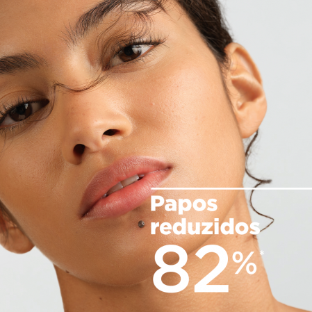 Papos reduzidos