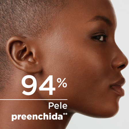 Pele preenchida