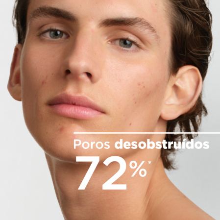 Poros desobstruídos