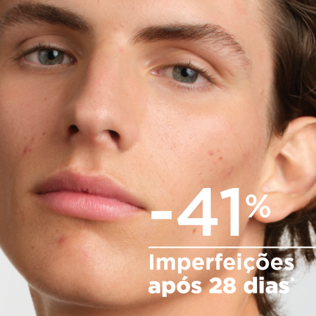 -41% imperfeições após 28 dias