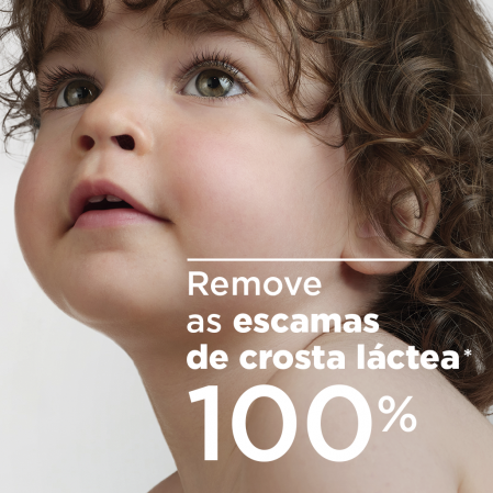 Remove as escamas de crosta láctea