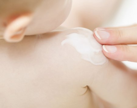 Eczema cream for kids