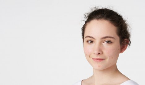 Bioderma - adolescent with acne-prone